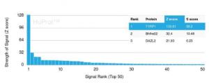 Analysis of protein array containing more than 19,000 full-length human proteins using Anti-TRP1 Antibody [TYRP1/3281] Z-Score and S- Score