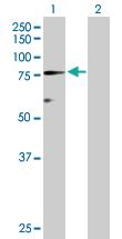 Anti-PROS1 Rabbit Polyclonal Antibody