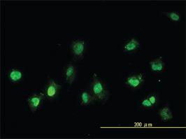 Anti-NEK11 Mouse Monoclonal Antibody [clone: 4E1-1F4]