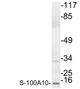 Western blot analysis of lysate from COLO cells using Anti-S-100A10 Antibody