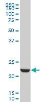 Anti-EFHD1 Mouse Monoclonal Antibody [clone: 1A8]