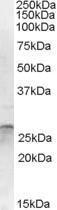 Anti-OTUB2 Antibody (A84541) (1 µg/ml) staining of Human Cerebellum lysate (35 µg protein in RIPA buffer). Primary incubation was 1 hour. Detected by chemiluminescence