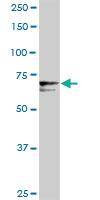 Anti-PROS1 Rabbit Polyclonal Antibody