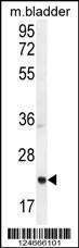 Anti-ASCL2 Rabbit Polyclonal Antibody (FITC (Fluorescein Isothiocyanate))