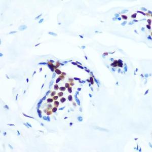 Immunohistochemistry analysis of paraffin-embedded human breast tissue using Anti-c-Jun (phospho Thr91) Antibody [ARC1548] (A308990) at a dilution of 1:100 (40x lens). Perform microwave antigen retrieval with 10 mM Tris/EDTA buffer pH 9.0 before commencing with IHC staining protocol.