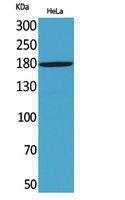 Anti-MRC2 antibody