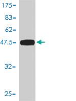 Anti-UBE2T Mouse Monoclonal Antibody [clone: 1E12-4A3]