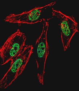 Anti-MYOD1 Rabbit Polyclonal Antibody (AP (Alkaline Phosphatase))