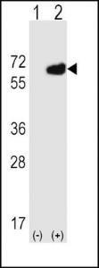 Anti-NT5E Rabbit Polyclonal Antibody (AP (Alkaline Phosphatase))