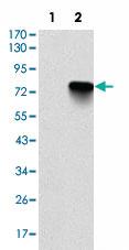 Anti-BMI1 Mouse Monoclonal Antibody [clone: 3E3]