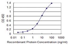 Anti-NEK11 Mouse Monoclonal Antibody [clone: 4E1-1F4]