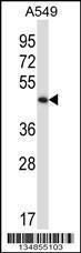 Anti-PHKG2 Rabbit Polyclonal Antibody (AP (Alkaline Phosphatase))