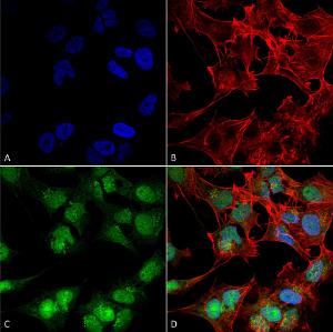 Immunocytochemistry/Immunofluorescence analysis of human neuroblastoma cell line (SK-N-BE, fixed in 4% formaldehyde for 15 min at room temperature, using Anti-Beclin 2 Antibody (A304915), at 1:100 for 60 minutes at room temperature