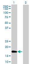 Anti-BTF3L4 Mouse Polyclonal Antibody