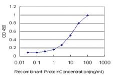 Anti-PHF21A Mouse Monoclonal Antibody [clone: 5A6]