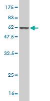 Anti-NQO1 Mouse Monoclonal Antibody [clone: 1E3-A6]