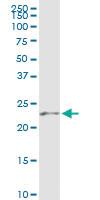 Anti-RAB39B Polyclonal Antibody Pair