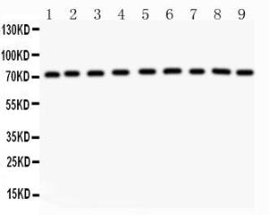 Anti-Growth hormone Receptor Rabbit Polyclonal Antibody