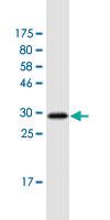 Anti-FZD2 Mouse Monoclonal Antibody [clone: 2C8]