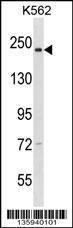 Anti-NCAPD3 Rabbit Polyclonal Antibody