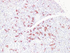 Immunohistochemical analysis of paraffin-embedded human Pancreas using Anti-Cytokeratin 7 Antibody