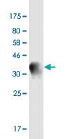 Anti-SYT13 Mouse Monoclonal Antibody [clone: 1H3]