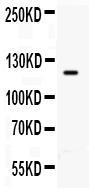 Anti-TLR8 Rabbit Polyclonal Antibody