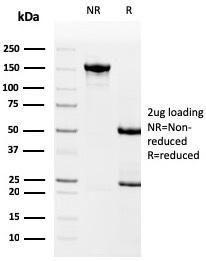 SDS-PAGE analysis of Anti-Drebrin Antibody [DBN1/3393] under non-reduced and reduced conditions; showing intact IgG and intact heavy and light chains, respectively. SDS-PAGE analysis confirms the integrity and purity of the antibody