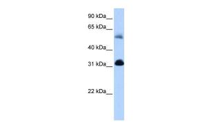 Anti-OXCT1 Rabbit Polyclonal Antibody