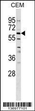 Anti-GPNMB Rabbit Polyclonal Antibody (FITC (Fluorescein Isothiocyanate))