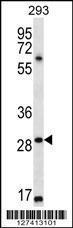 Anti-MESP1 Rabbit Polyclonal Antibody (HRP (Horseradish Peroxidase))