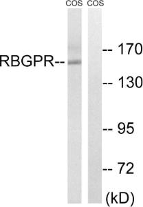 Western blot analysis of lysates from COS cells using Anti-RAB3GAP2 Antibody. The right hand lane represents a negative control, where the Antibody is blocked by the immunising peptide