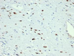 Antibody anti-MYOD1 MYOD13418R 100 µg