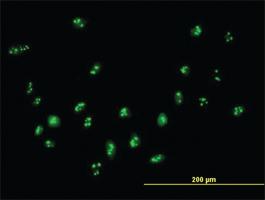 Anti-DDX18 Mouse Polyclonal Antibody