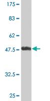 Anti-UBE2T Mouse Monoclonal Antibody [clone: 4G1-4C2]