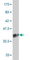 Anti-TSNAXIP1 Mouse Monoclonal Antibody [clone: 1D6]