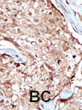 Anti-PAPSS2 Rabbit Polyclonal Antibody