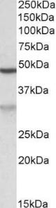 Anti-MOB2 Antibody (A82936) (0.02µg/ml) staining of Jurkat lysate (35µg protein in RIPA buffer). Primary incubation was 1 hour. Detected by chemiluminescence.