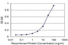 Anti-PROX1 Mouse Monoclonal Antibody [clone: 4D1]