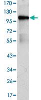 Anti-BMX Mouse Monoclonal Antibody [clone: 1C6]