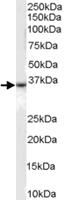 Anti-ACKR1 Goat Polyclonal Antibody