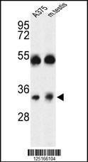 Anti-ORAI1 Rabbit Polyclonal Antibody