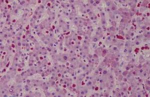 Anti-CARD11 Rabbit polyclonal antibody