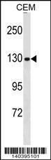 Anti-NCAPG Rabbit Polyclonal Antibody (HRP (Horseradish Peroxidase))