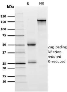 SDS-PAGE analysis of Anti-ZNF846 Antibody [ZNF846/2687] under non-reduced and reduced conditions; showing intact IgG and intact heavy and light chains, respectively. SDS-PAGE analysis confirms the integrity and purity of the antibody