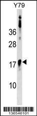 Anti-BCL7B Rabbit Polyclonal Antibody (HRP (Horseradish Peroxidase))