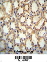 Anti-KCNT2 Rabbit Polyclonal Antibody (FITC (Fluorescein Isothiocyanate))