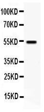 Anti-VIP Receptor 1 Rabbit Polyclonal Antibody