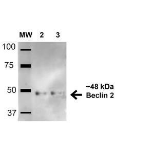 Western blot analysis of human HeLa and HEK293Trap cell lysates showing detection of 48.1 kDa Beclin 2 protein using Anti-Beclin 2 Antibody (A304915) at 1:1,000 for 1 hour at room temperature