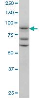 Anti-HTLV1 Mouse Monoclonal Antibody [clone: 2C3]